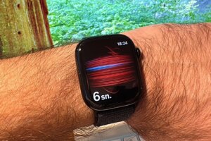 The dream of a glucose sensor for Apple Watch has reached a new stage