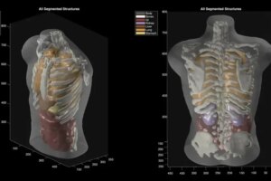 Artificial intelligence company Midjourney enters health technologies